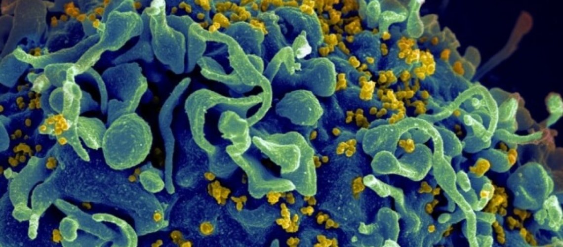 5-22-2018-MIT-HIV-Vaccine-01_0.jpg