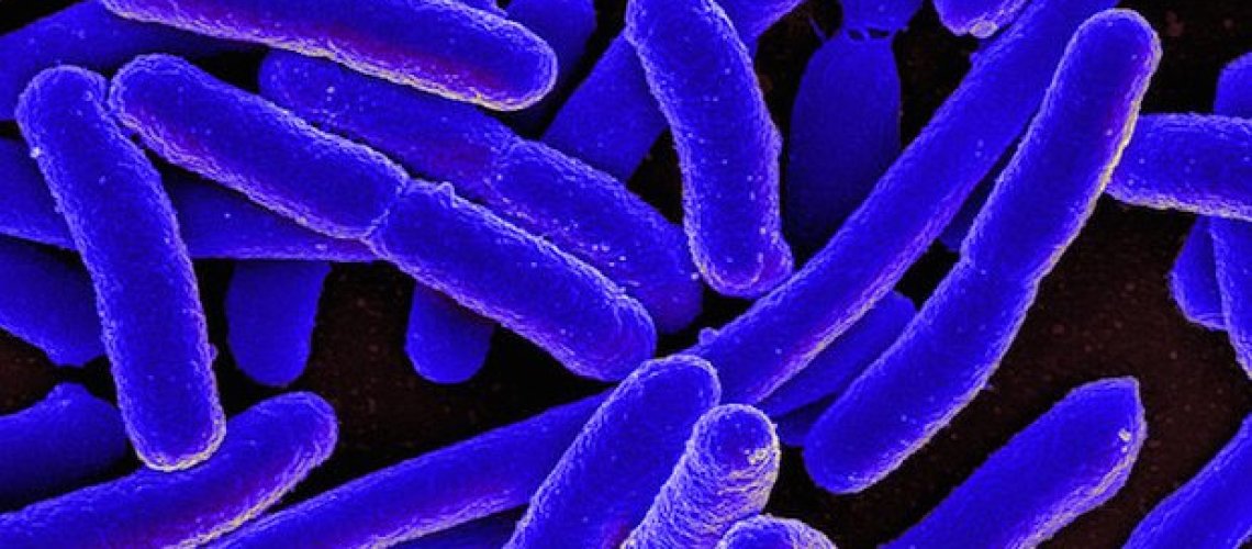 af-c-c-d-b-a-e-ecoli.jpg