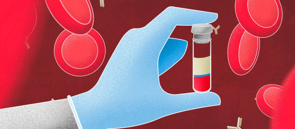 antibodytestingvirus-x-.jpg