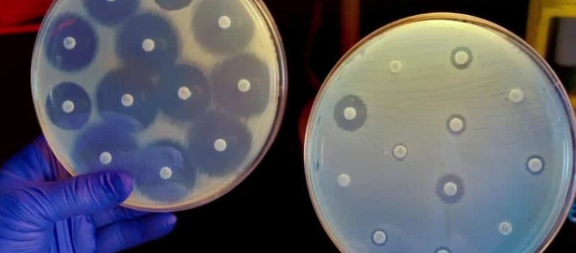 cdc-director-superbug-antibiotics-frieden-intv-super-tease.jpg