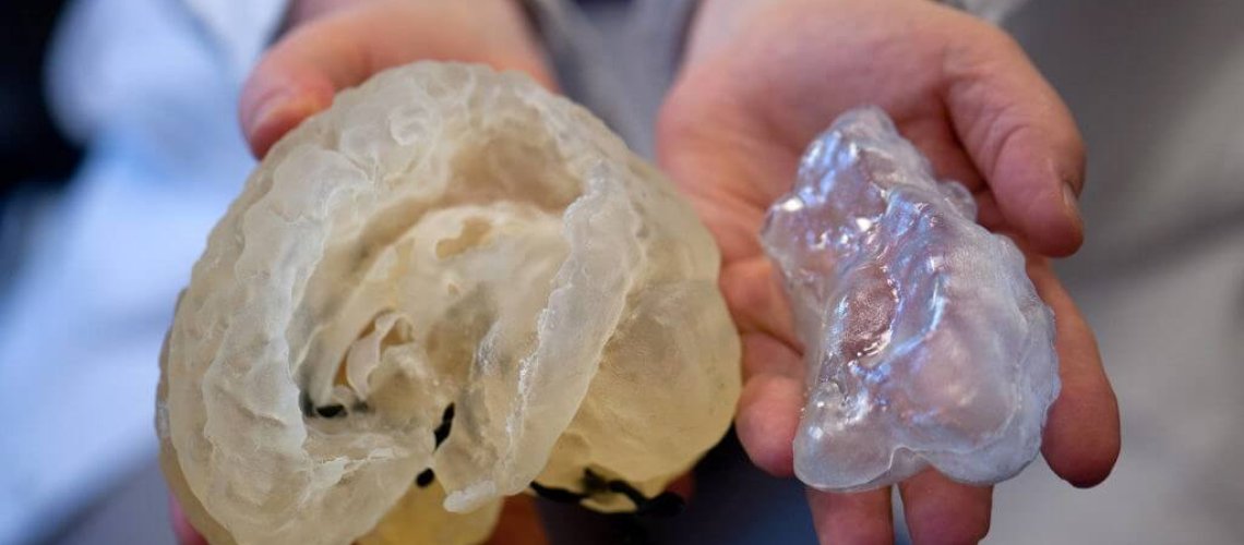 d-printed-model-brain-epilepsy-joseph-madsen-x-.jpg