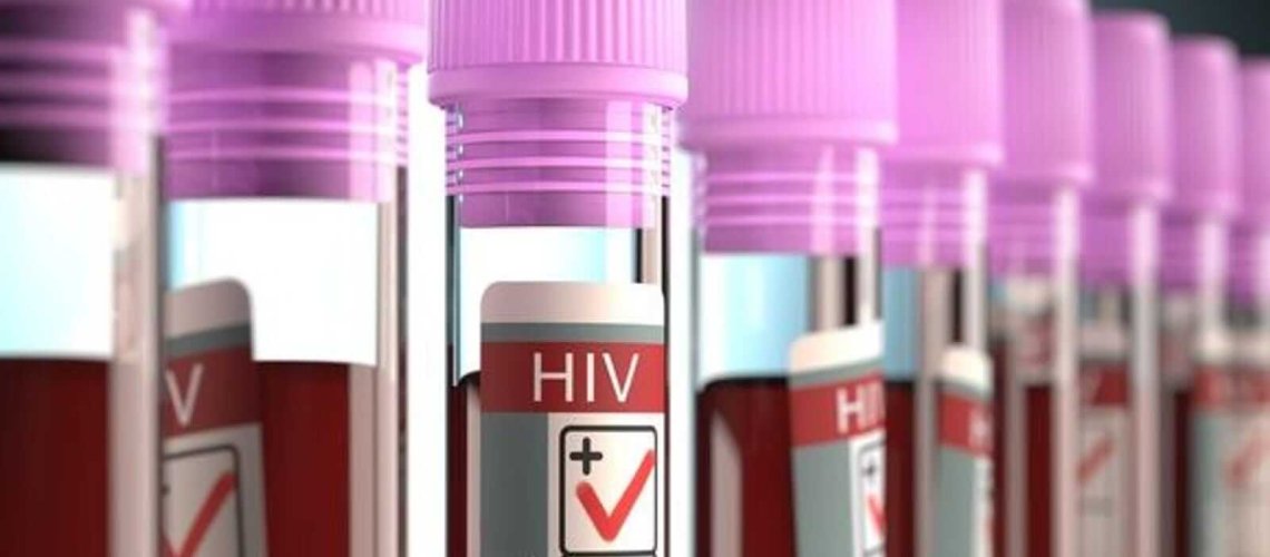 hiv-positive-blood-vials-large.jpg