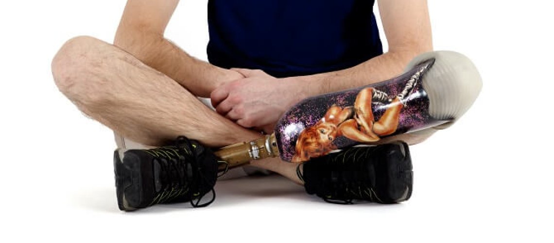 limb-regeneration.jpg