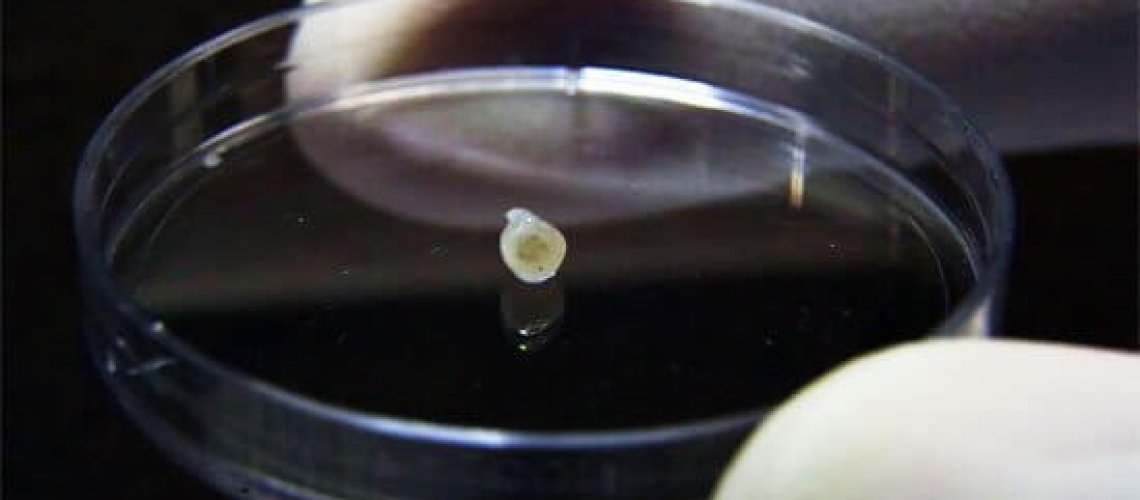 midbrain-in-petri-dish-the-agency-for-science.jpg