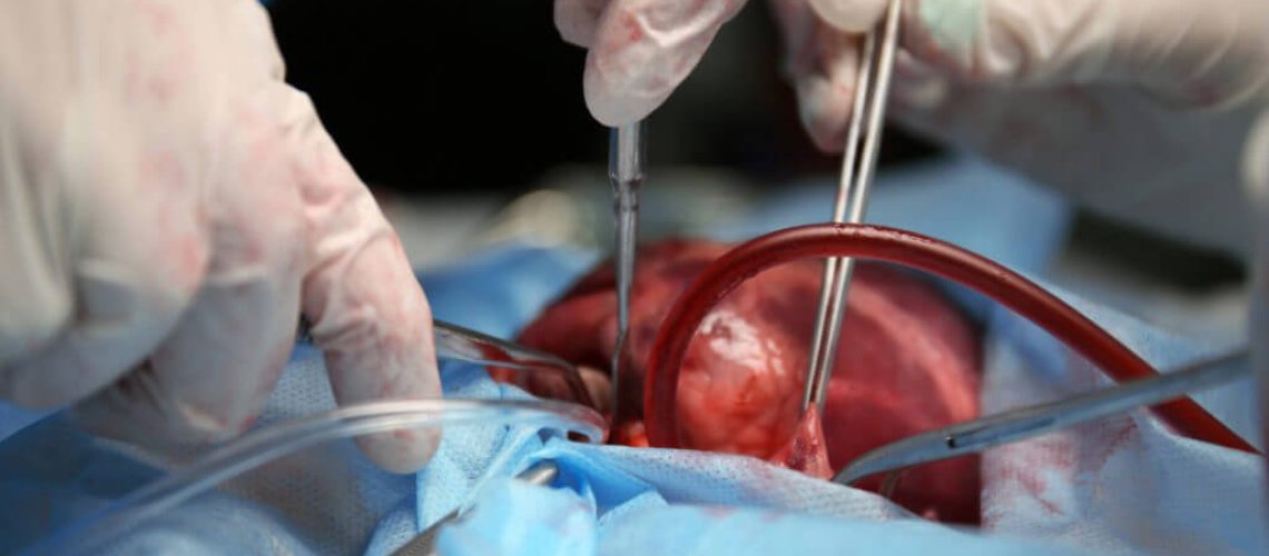 transplant-1024x683.jpg